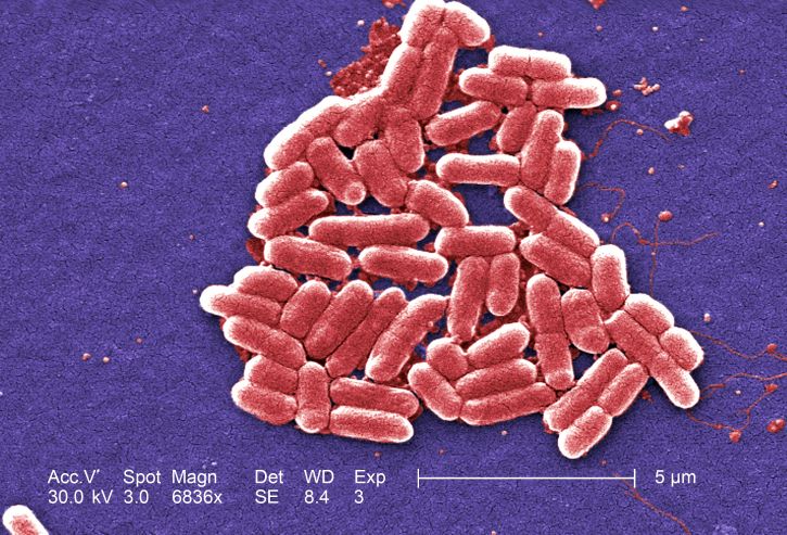 Figure 1.3. Escherichia coli (E. coli) bacteria, seen in this scanning electron micrograph, are normal residents of our digestive tracts that aid in the absorption of vitamin K and other nutrients. However, virulent strains are sometimes responsible for disease outbreaks.