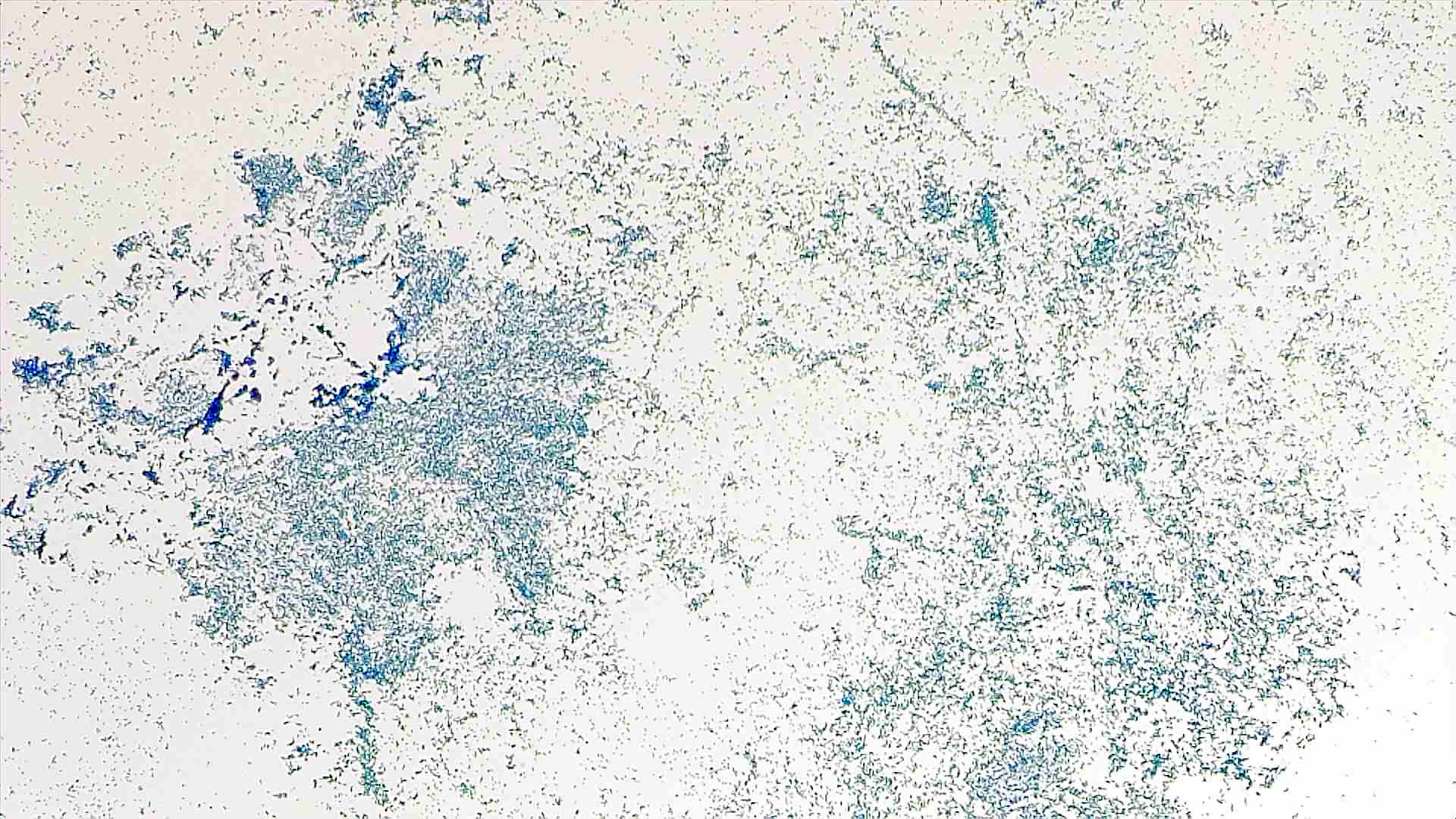 White background with thousands of small, blue Escherichia coli cells scattered across.