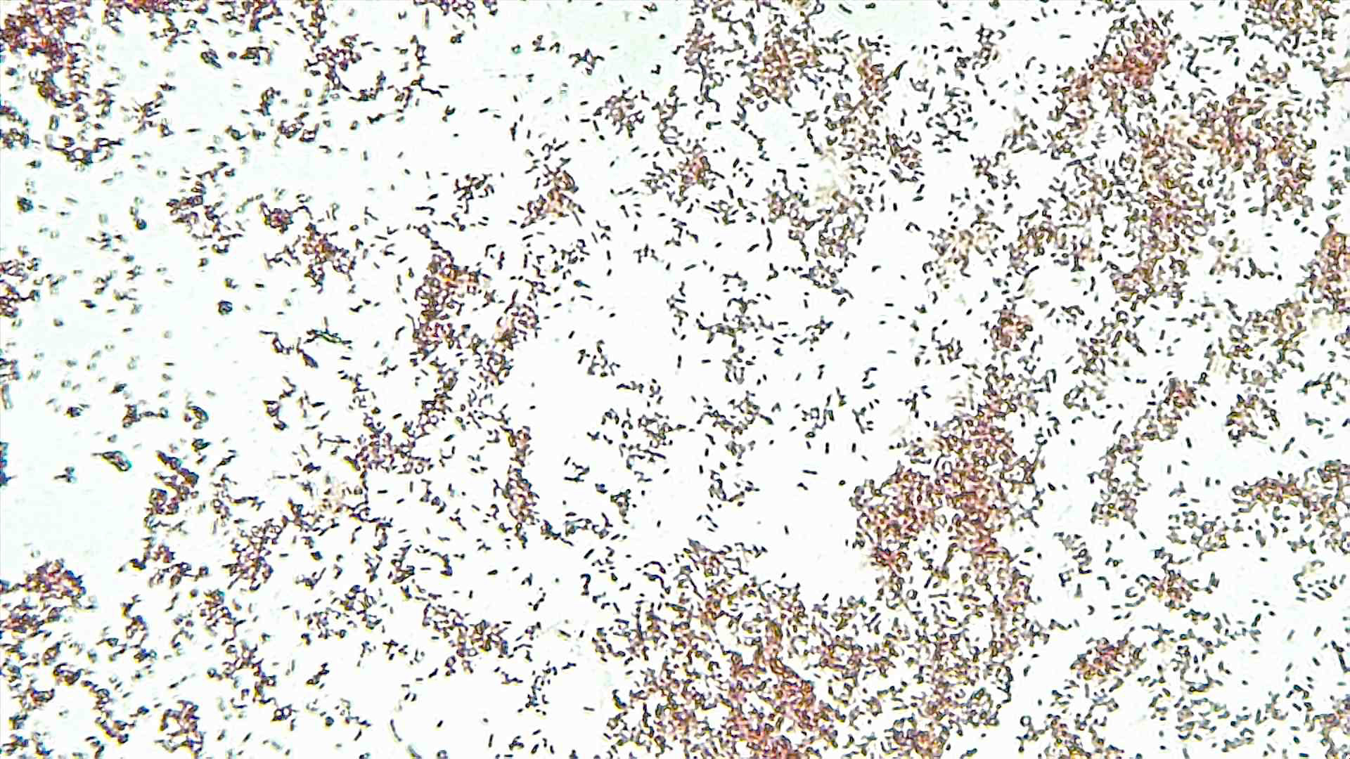 White background with about 1000 small, red, rod-shaped Escherichia coli cells scattered across.