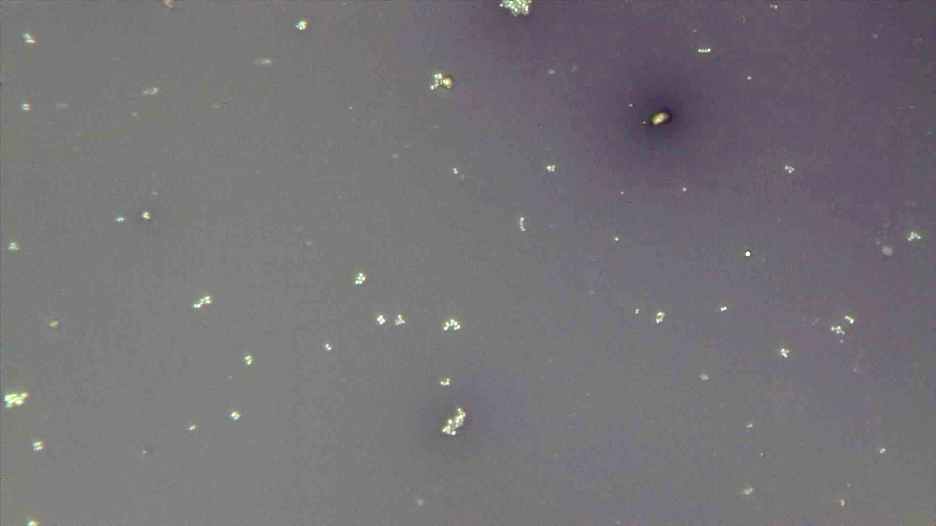 Dark background with several clusters of white, round cells. 