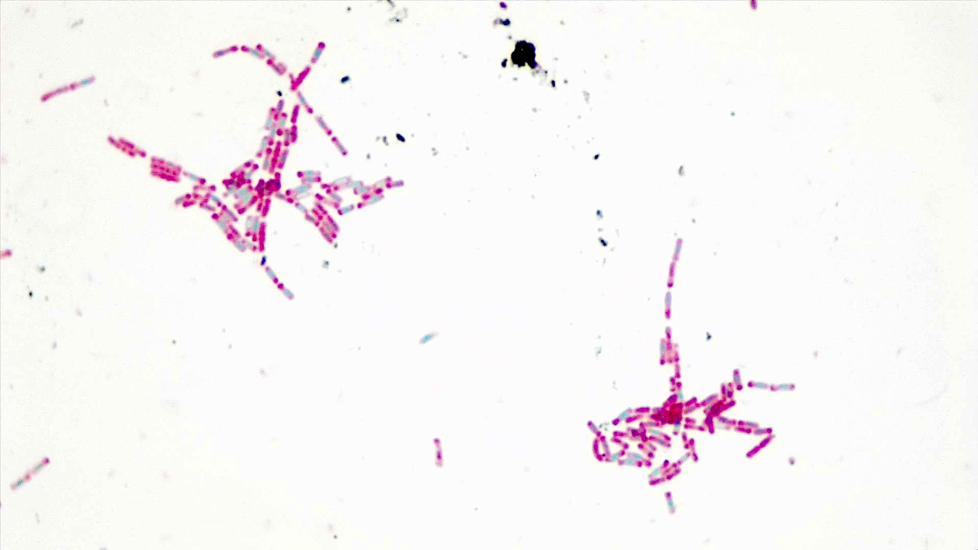 Light background with about 50 rod-shaped pink cells with green oval endospores inside