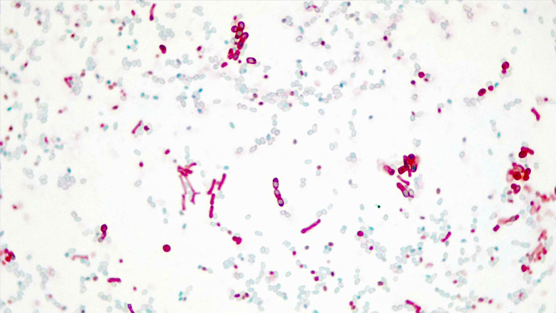 Light background with  few rod-shaped pink cells and many green oval endospores