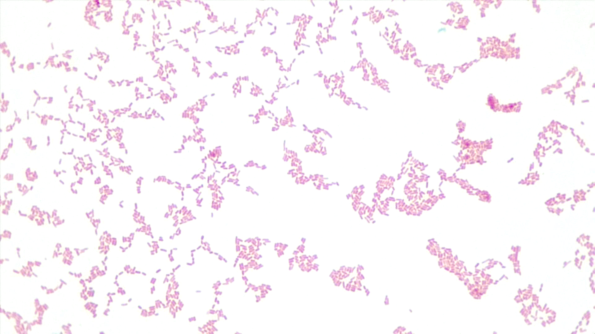 Light background with many rod-shaped pink cells; no green oval endospores seen