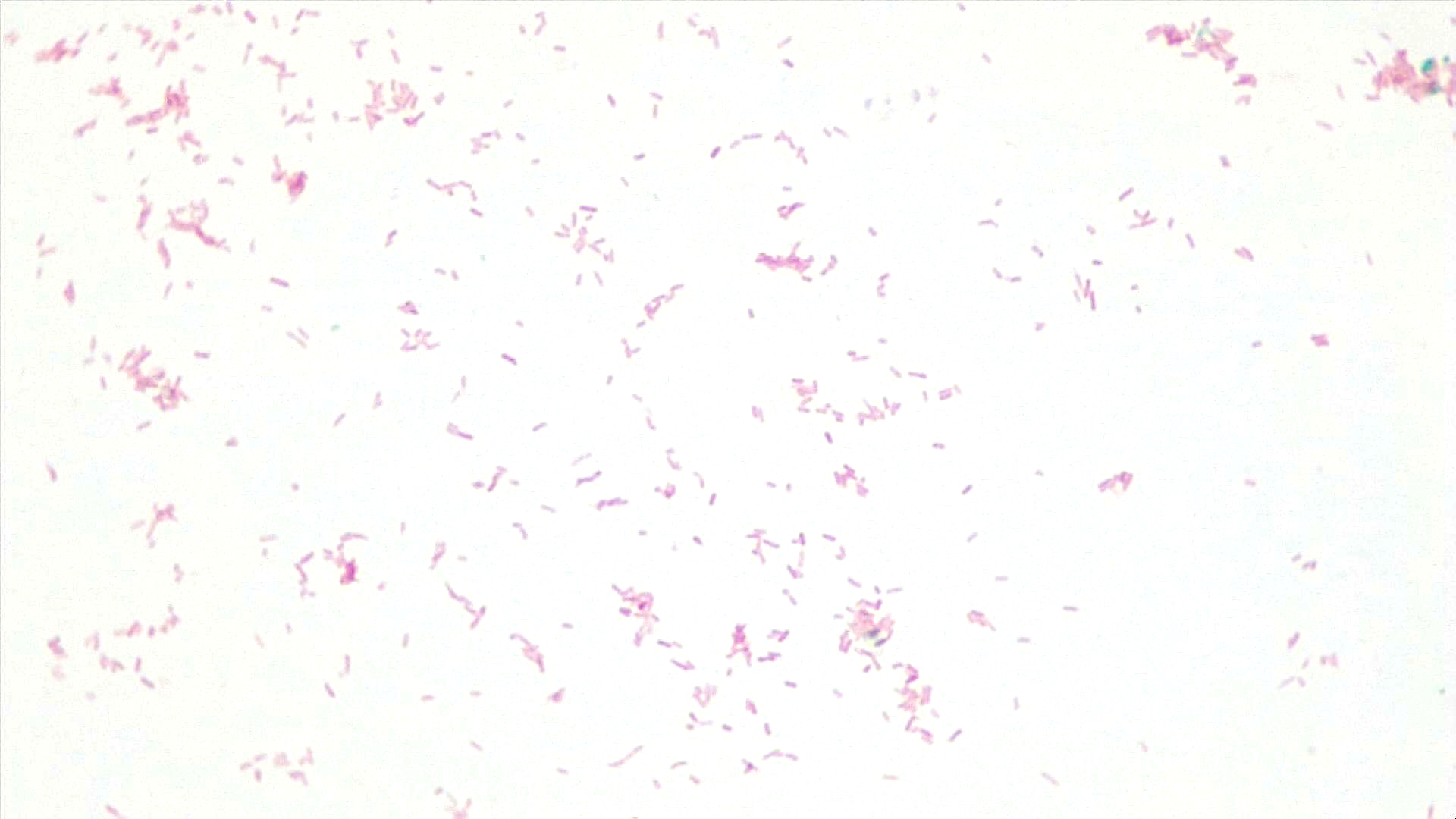 Light background with many rod-shaped pink cells; no green oval endospores seen