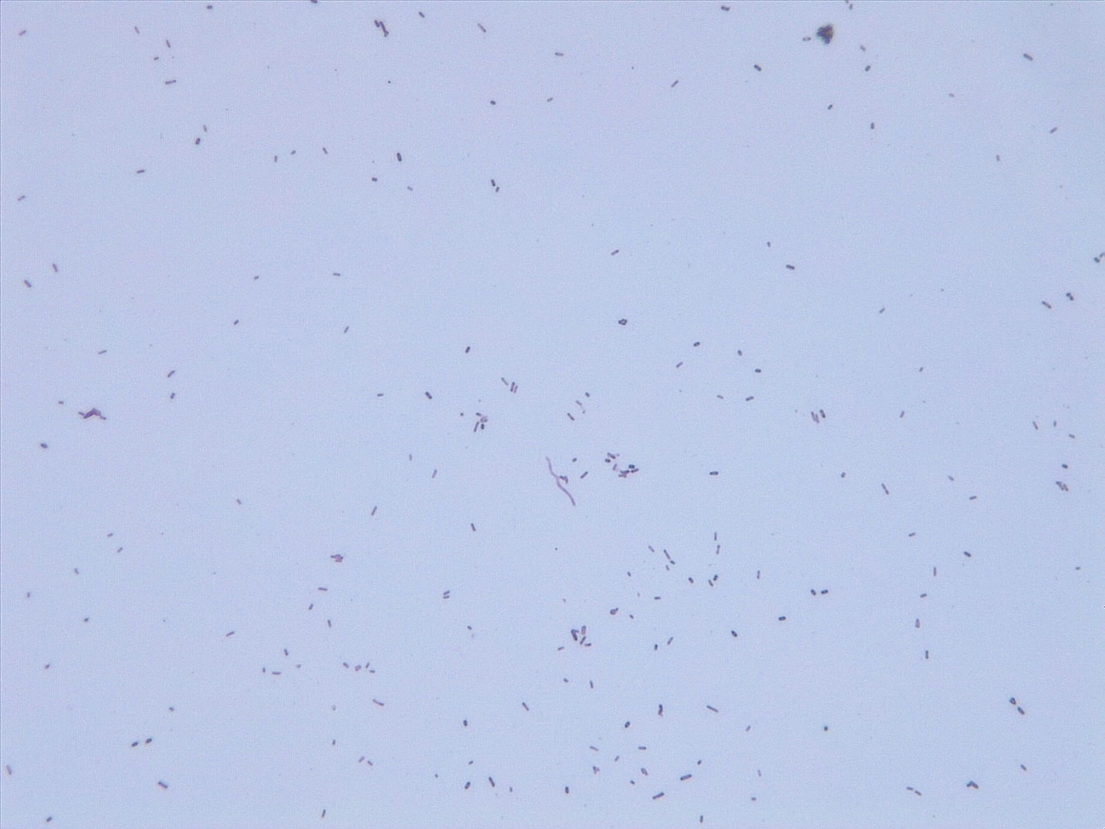 White background with hundreds of small, pink, rod-shaped Escherichia coli cells scattered across.