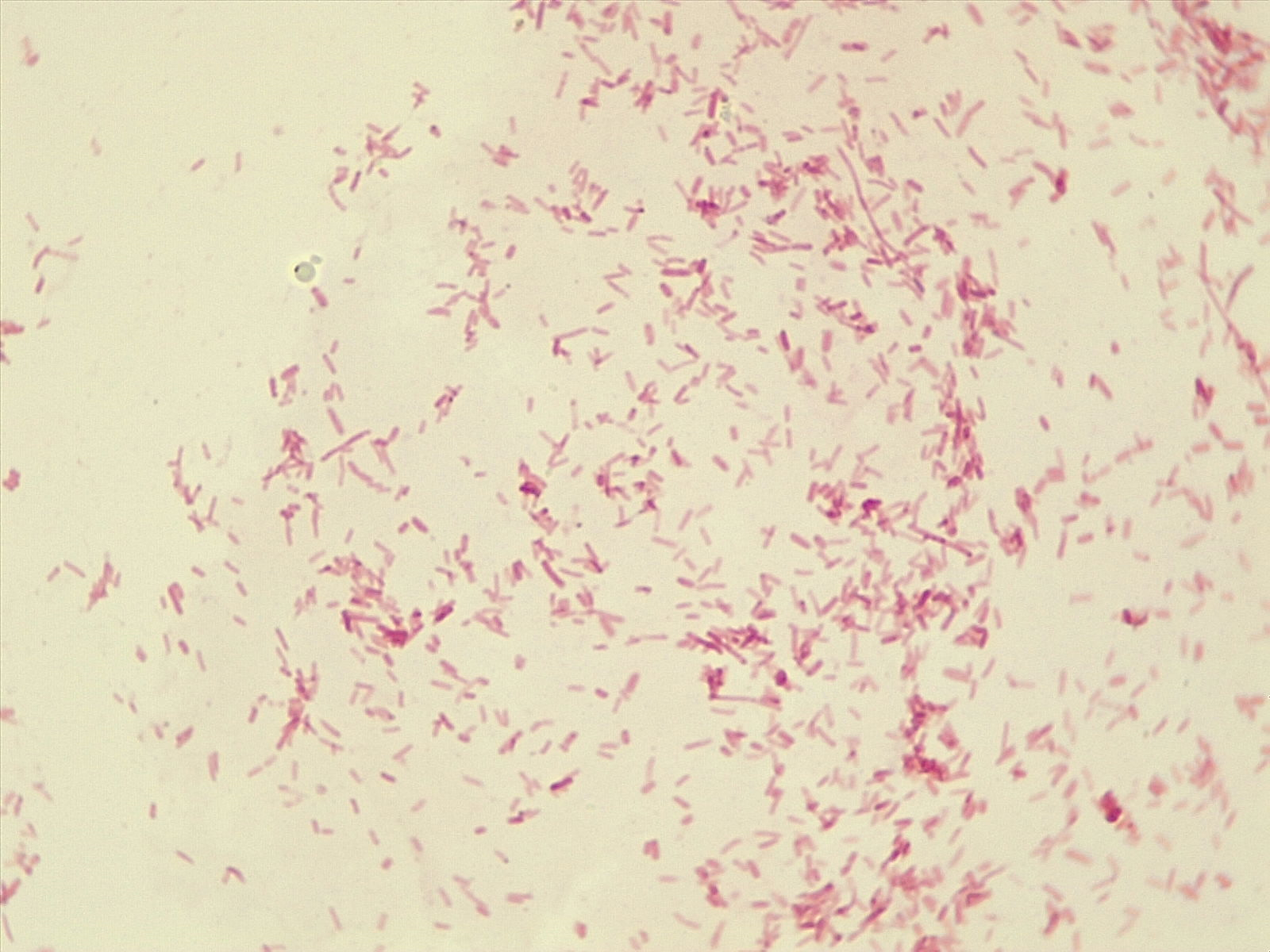 White background with hundreds of small, pink, rod-shaped Escherichia coli cells scattered across.