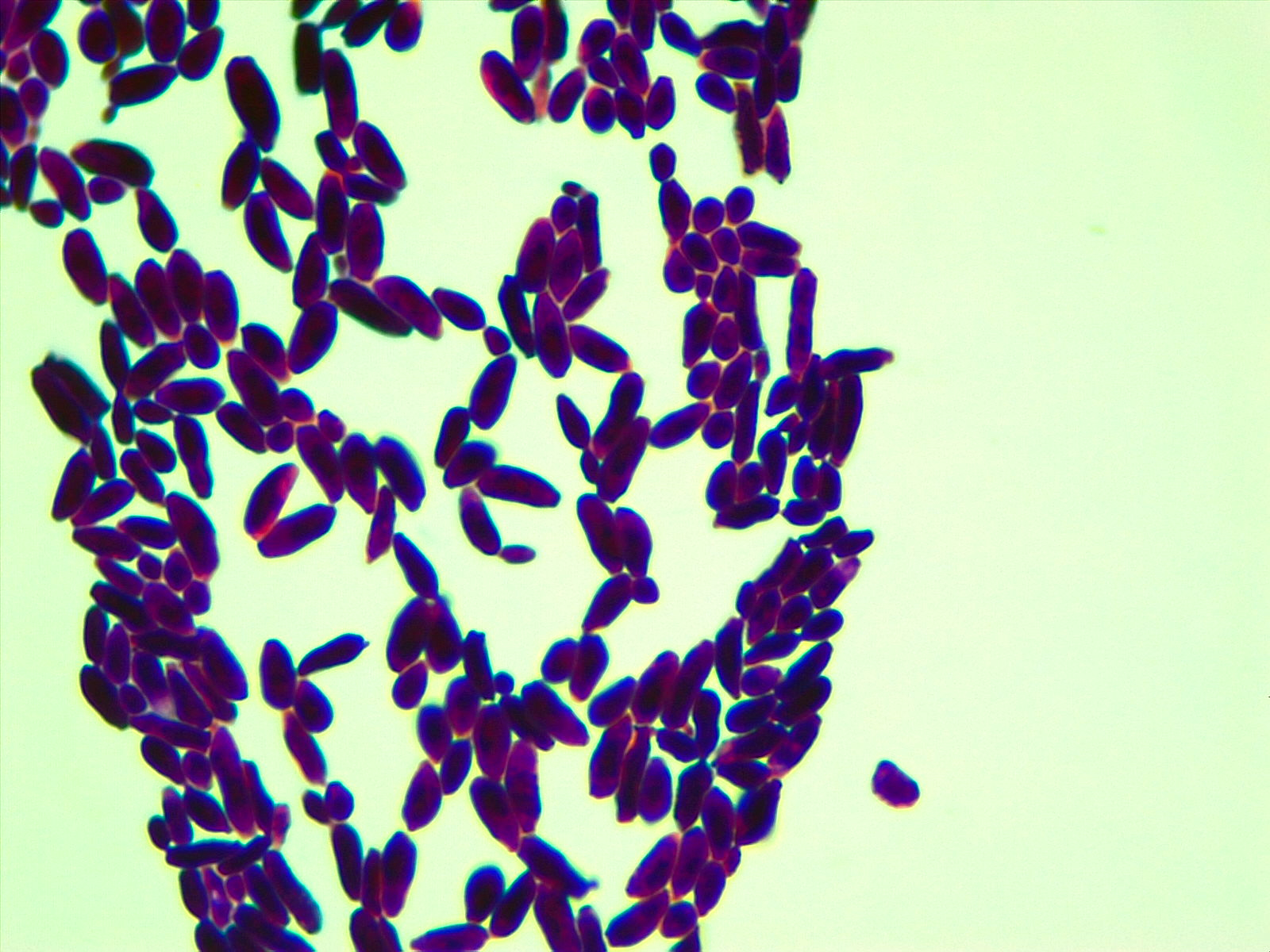 Micrograph Candida albicans Gram stain 1000x