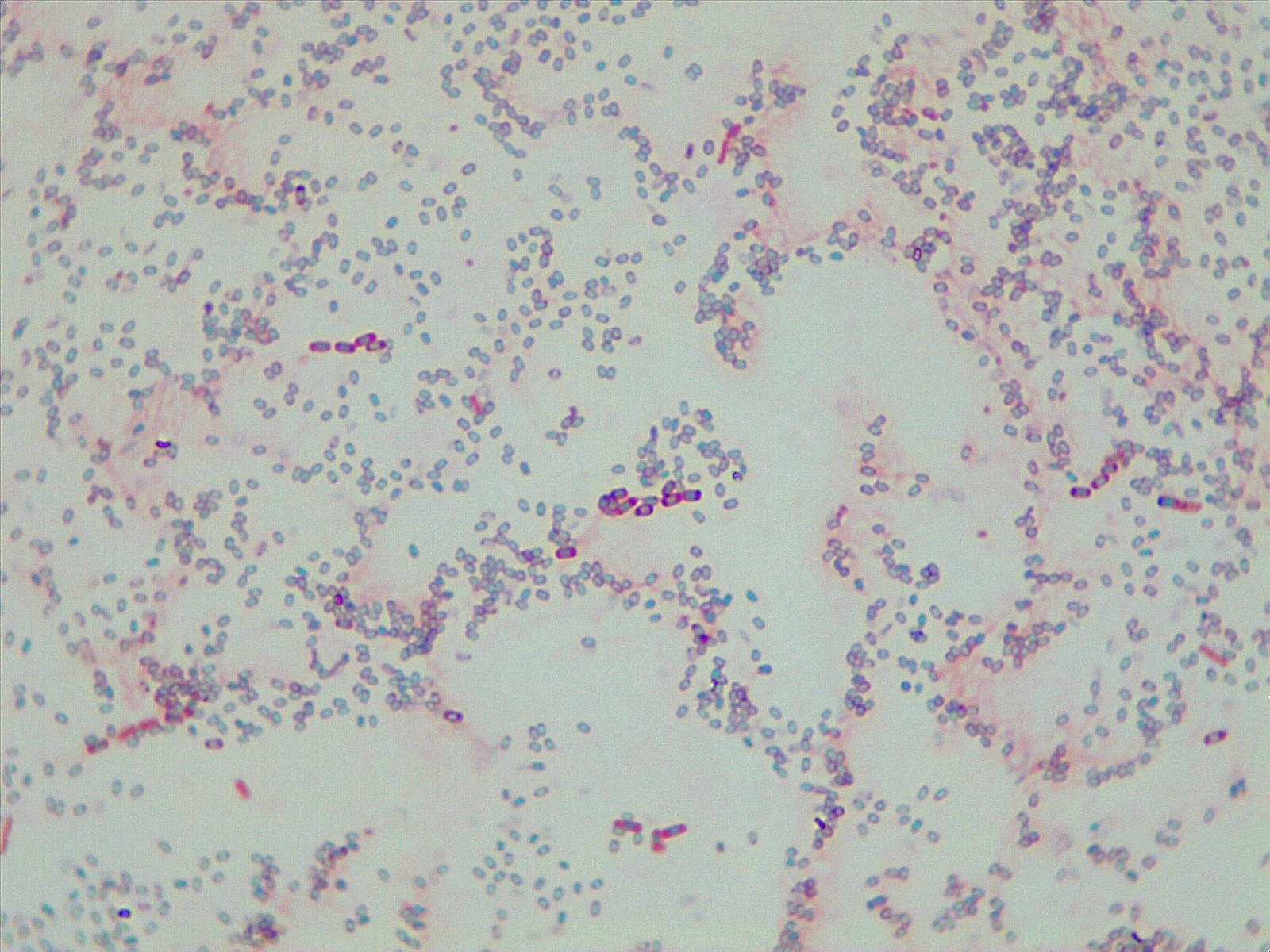 Light background with few rod-shaped pink cells and many green oval endospores