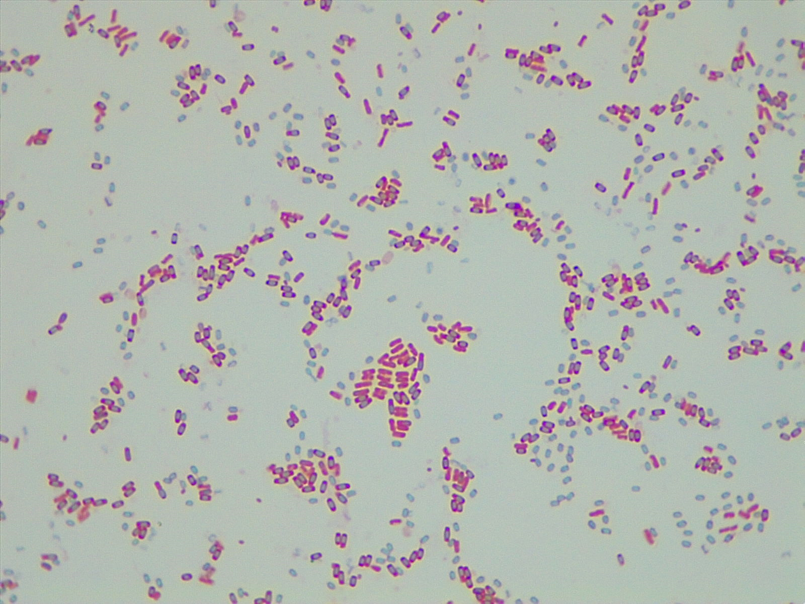 Light background with mixture of pink rods, pink rods with green endospores inside, and released green endospores.