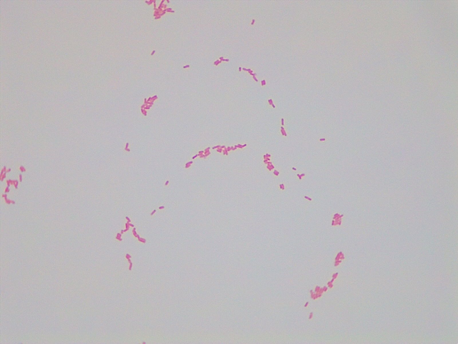 White background with several pink, rod-shaped Enterobacter aerogenes cells.