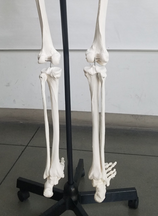 back view of lower leg is comprised of two bones: the tibia (the larger bone) and the fibula (the thinner outside bones)