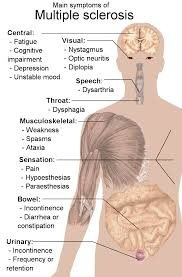 MS can affect many areas of the body, as indicated here.